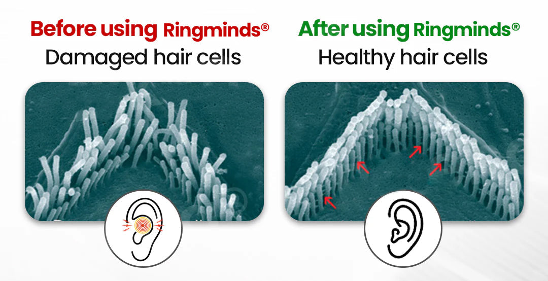 Kyianor™ Smart, Self-Fitting Bluetooth Hearing Aids (App Controlled)
