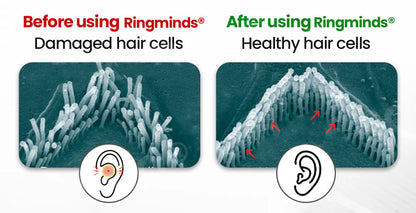 Kyianor™ Smart, Self-Fitting Bluetooth Hearing Aids (App Controlled)