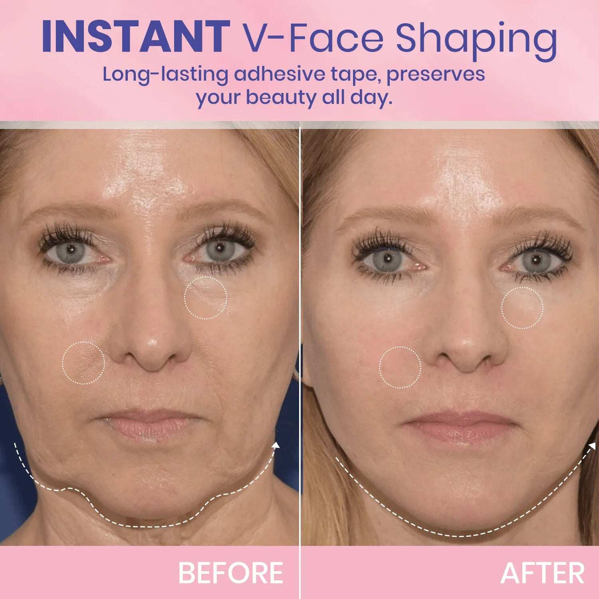 V-Face 👑 Lifting Invisible Adhesive Tape