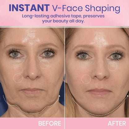 V-Face 👑 Lifting Invisible Adhesive Tape